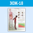 Плакат «Риски ожирения» (ЗОЖ-18, пластик 2 мм, A1, 1 лист)